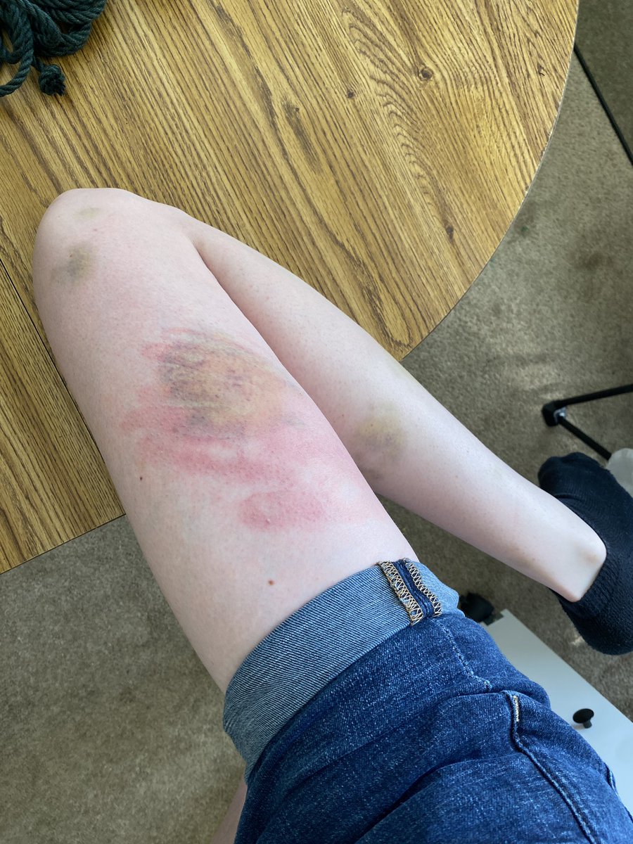CamrynCorder's tweet photo. bruise on canvas, 2026 https://t.co/ajqW7UUgjW
