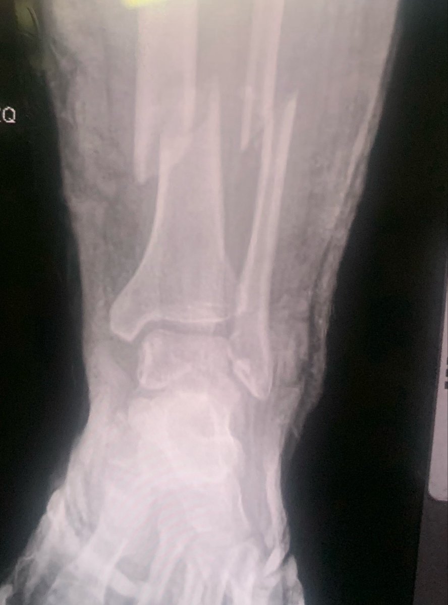 Namuel's tweet photo. Ouch https://t.co/wLMzaS9rnT
