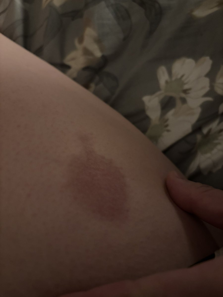 772🎀kiki tweet media