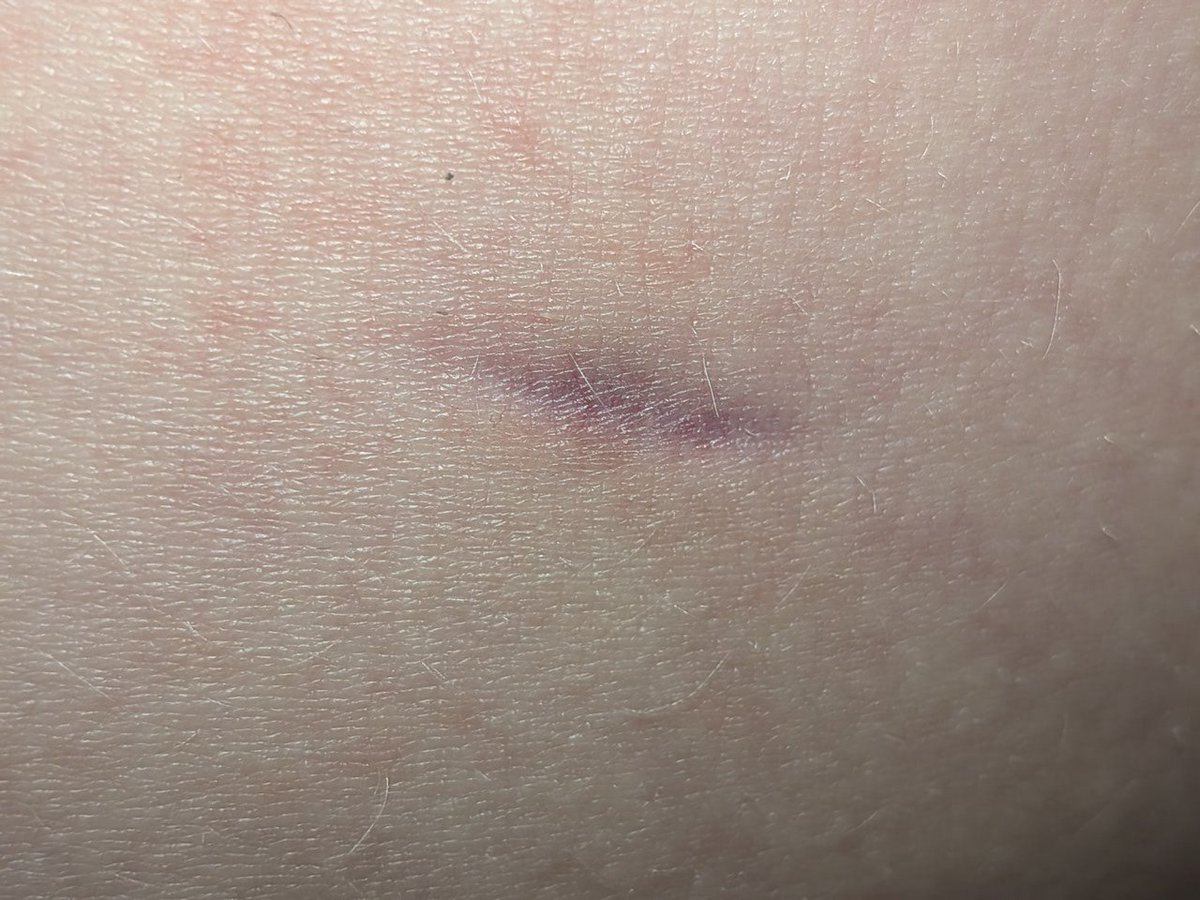 brimsket#shedshedshedshedshed tweet media