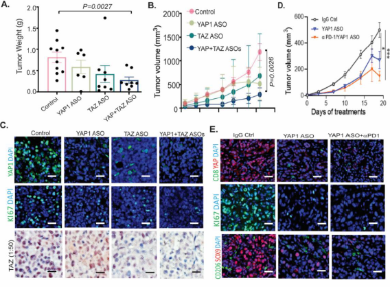 CHP_journal's tweet photo. 🚀 Translational relevance:
Dual YAP1 + TAZ targeting:
✔️ ↓ Tumor growth (PDX)
✔️ ↓ Proliferation markers (KI67)
✔️ ↑ CD8+ T cell infiltration
✔️ ↓ M2 macrophages
💡 Enhanced response with anti-PD1 https://t.co/q92GhrJgnI