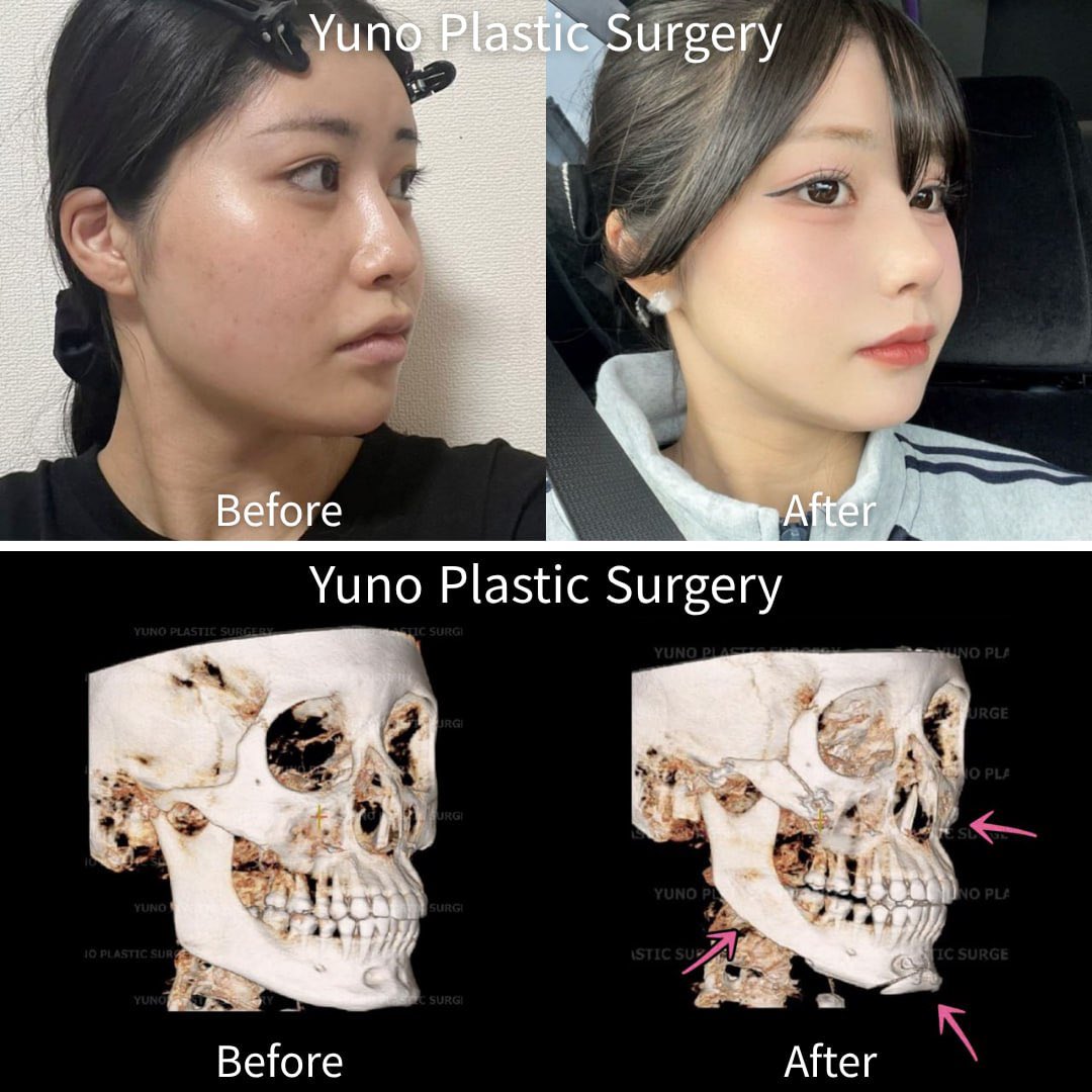 Yuno Plastic Surgery_ENG (@yuno_eng) / Posts / X