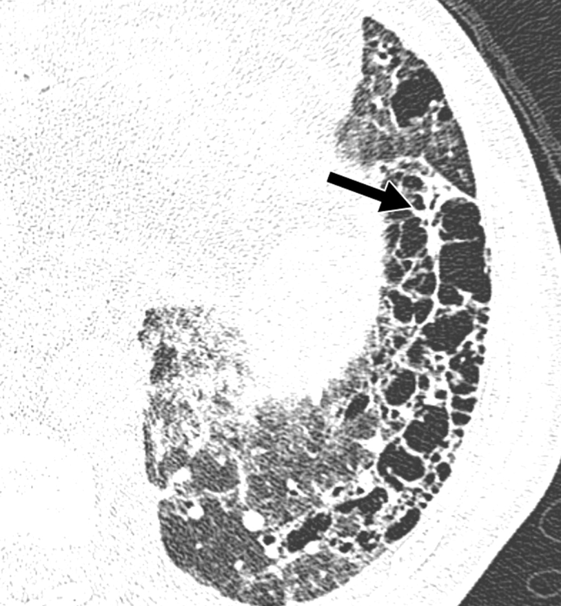放射線科医モルガナイト tweet media
