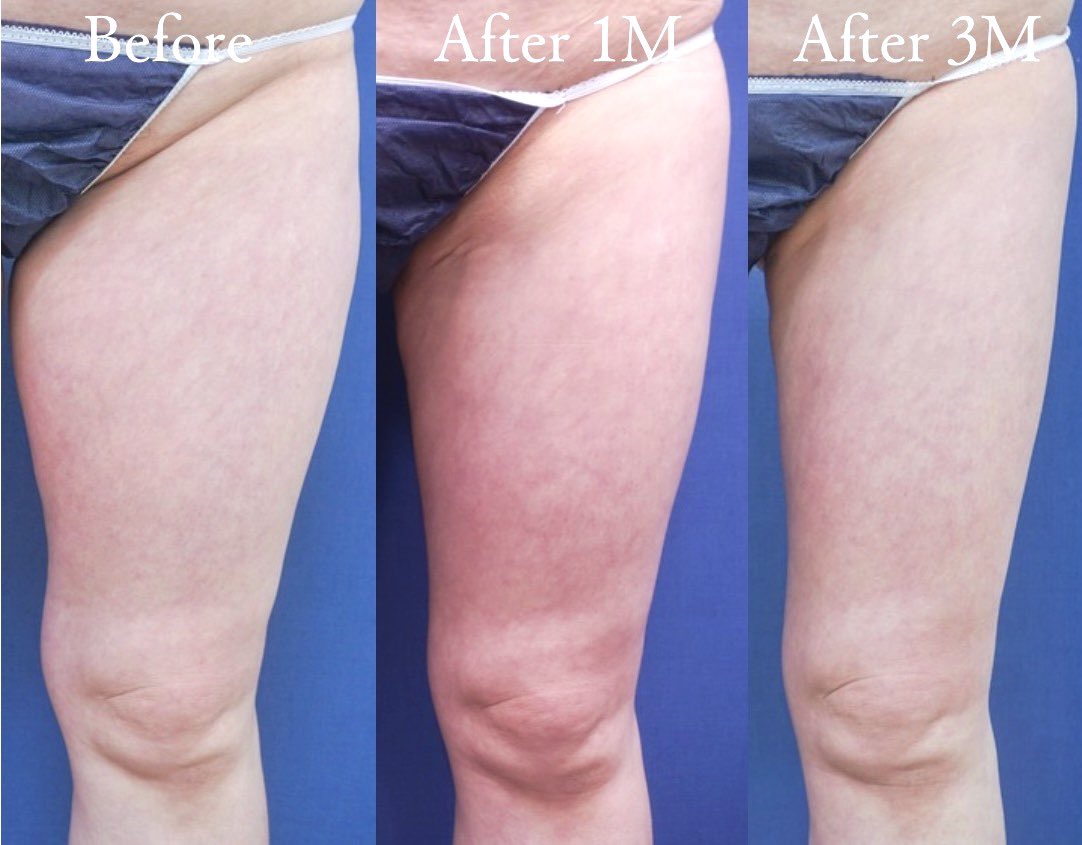 淺川先生 【小顔輪郭/ボディメイク】 tweet media