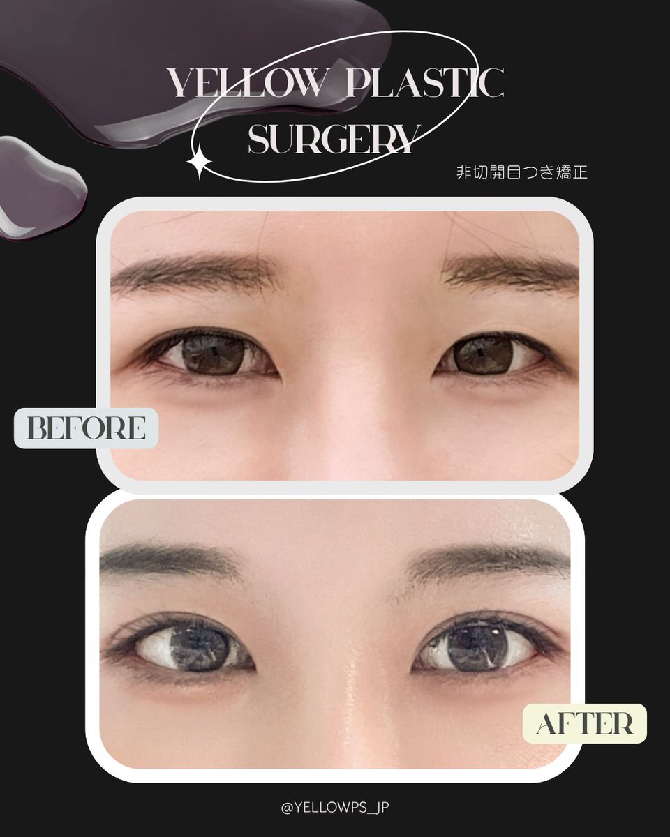 💛イエロー美容整形外科(公式)💛 tweet media