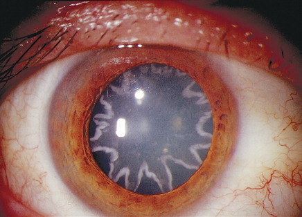 セツナノマタタキ🟣 tweet media