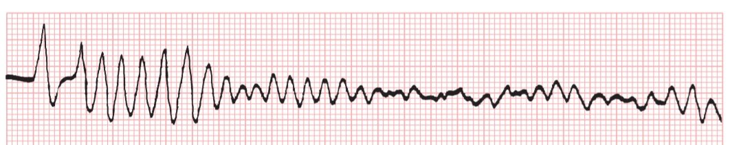 CardiovascularCorner tweet media