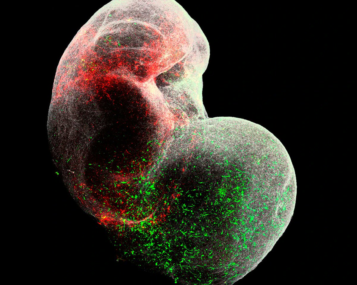 manuelacasasoli's tweet image. How to study human #brain development and disease.

"The development of the human brain, with its extraordinary range of cognitive abilities, is an awe-inspiring feat of evolution. Each of its tens of billions of cells must be born at precisely the right time, migrate to the