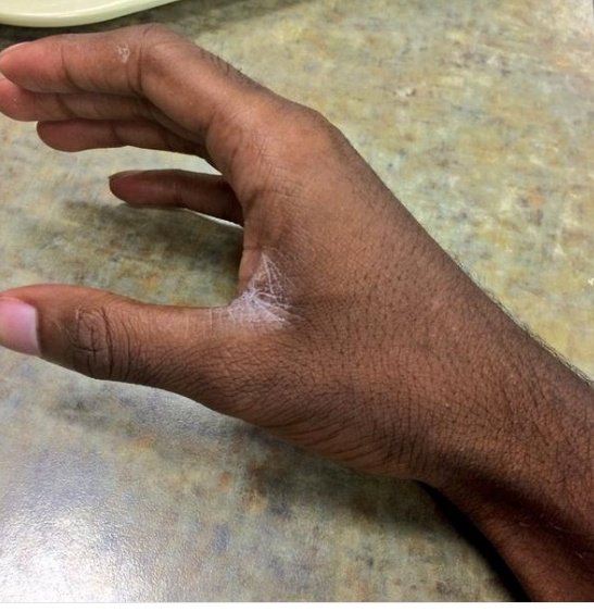 Raymond Dart(Mr Dart) tweet media