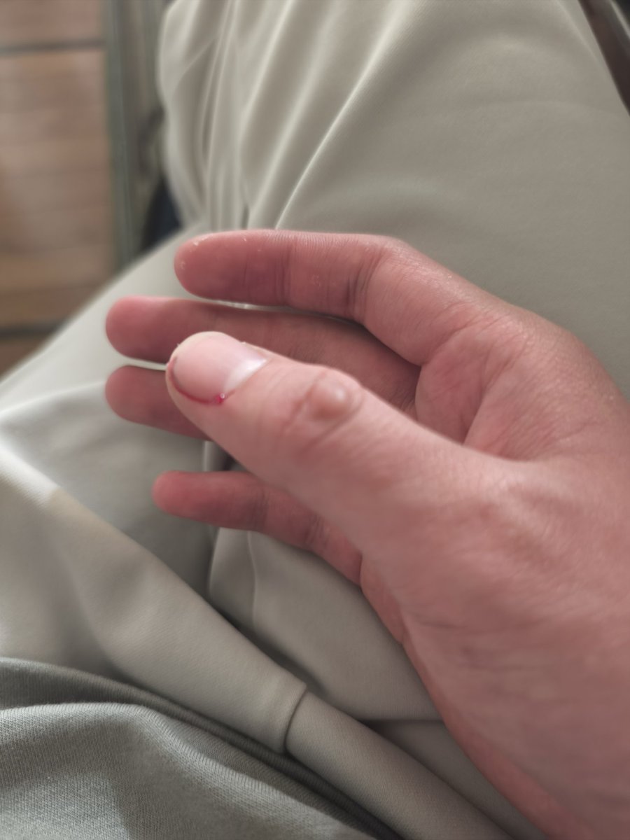 ﾁｬﾝﾗﾅ🐸 tweet media