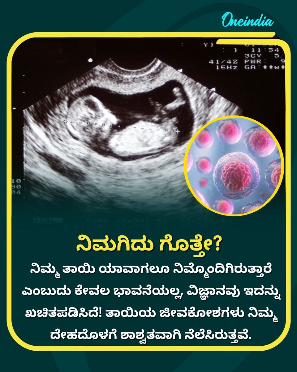 OneindiaKannada's tweet photo. ನಿಮ್ಮ ತಾಯಿ ಯಾವಾಗಲೂ ನಿಮ್ಮೊಂದಿಗಿರುತ್ತಾರೆ ಎಂಬುದು ಕೇವಲ ಭಾವನೆಯಲ್ಲ, ವಿಜ್ಞಾನವು ಇದನ್ನು ಖಚಿತಪಡಿಸಿದೆ! ತಾಯಿಯ ಜೀವಕೋಶಗಳು ನಿಮ್ಮ ದೇಹದೊಳಗೆ ಶಾಶ್ವತವಾಗಿ ನೆಲೆಸಿರುತ್ತವೆ
.
.
#Motherhood #ScienceFacts #Microchimerism #MotherAndChild #OneindiaKannada https://t.co/snFkZuULfu