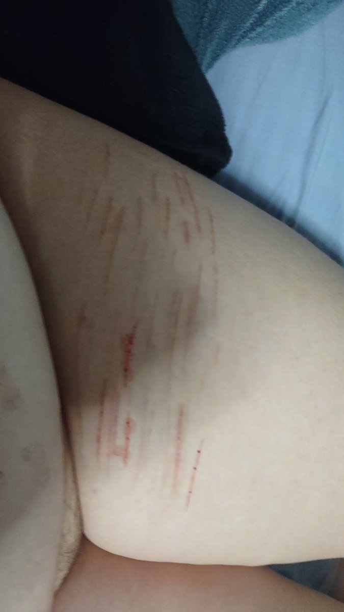 tsukasa of shtwt tweet media