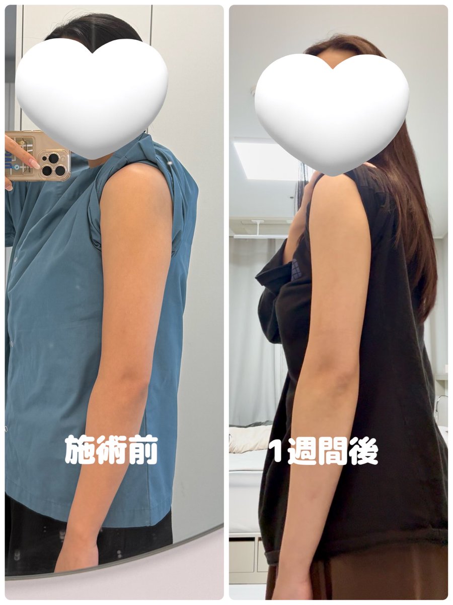 ｼｭｳﾏｲ©︎韓国在住 tweet media