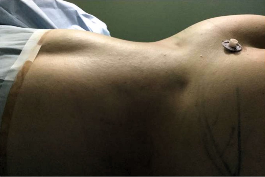 志田雅明 美容外科医|ハイブリッド豊胸・バービーウエスト・脂肪吸引・脂肪豊胸 tweet media