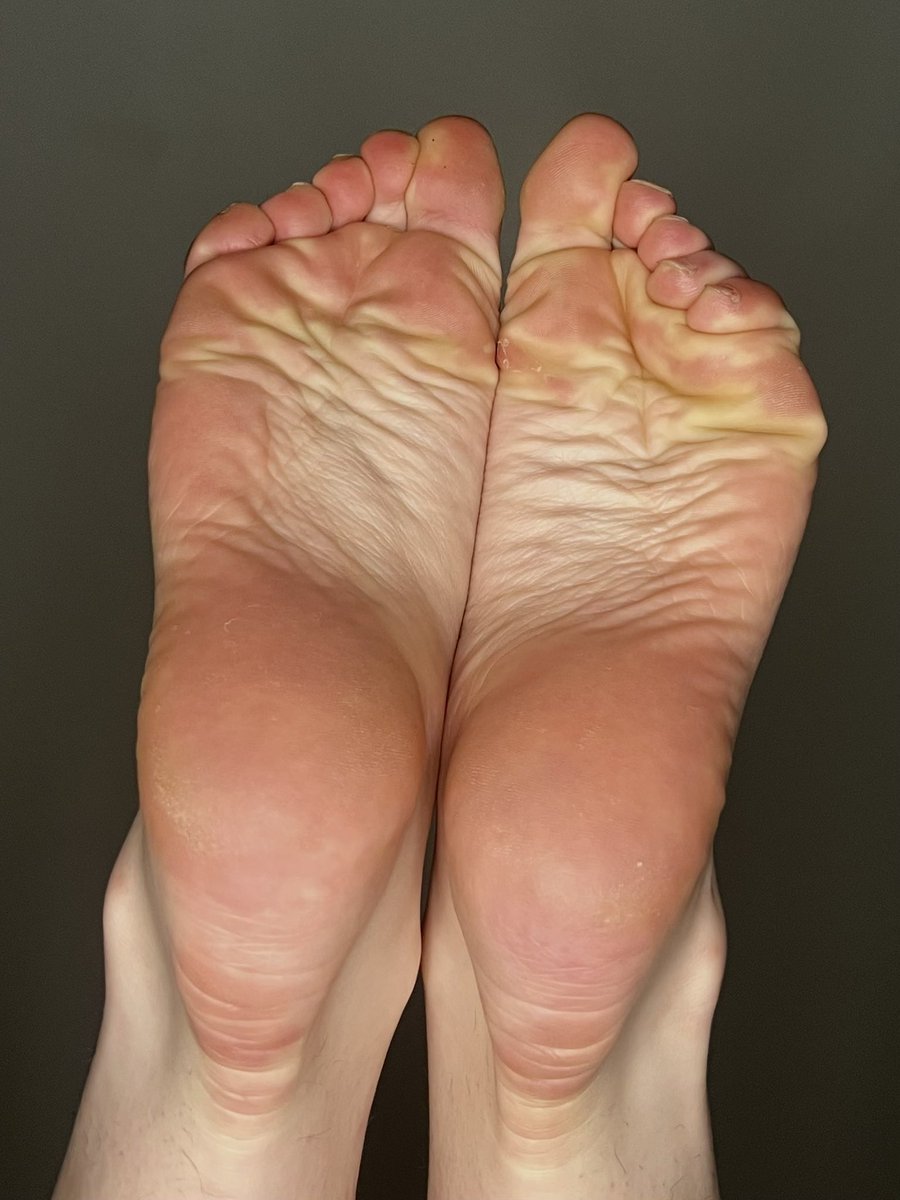 MidnightSoles77's tweet image. Your view from below. Count every single wrinkle and thank your goddess 🖤

#wrinkles #soles #wrinklysoles #footlovers #feetfetısh