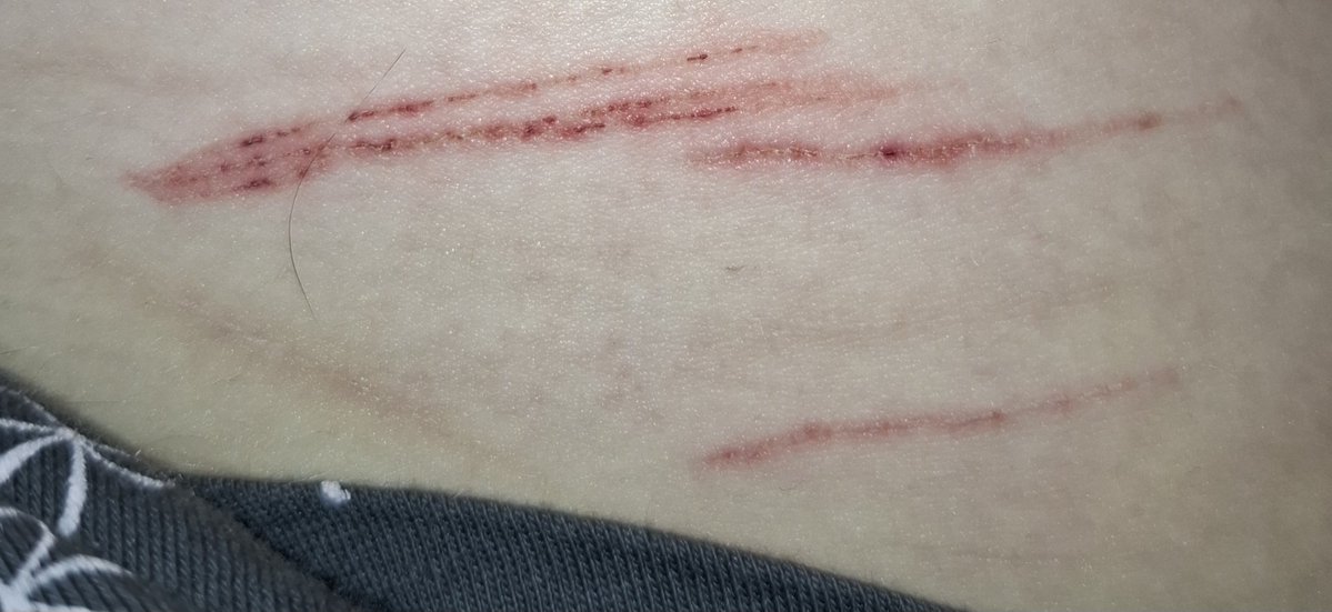 🐈⬛⸝꙳.˖quill of shedtwt ౨ৎ tweet media