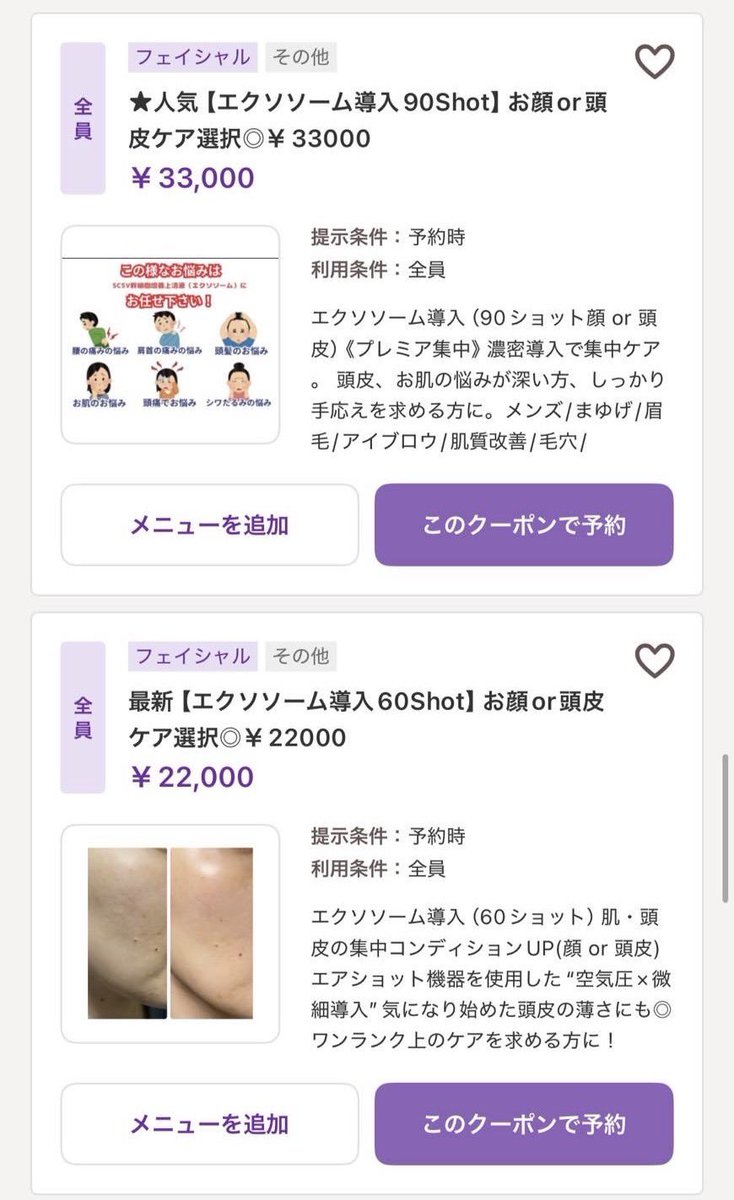 chingcehansuki's tweet photo. エクソソーム、点滴はガン細胞増える噂もあって大反対だけど、肌導入だけならマジで神だと思う。この前サロンでやったら、冗談抜きで今までのどの肌育注射より発光して感動してる…。しかも謎に頬骨セットバックの腫れまでインディバ級に引いた。

理論は正直不明だが、とにかくコスパ神だった https://t.co/fnEAxx9CIQ