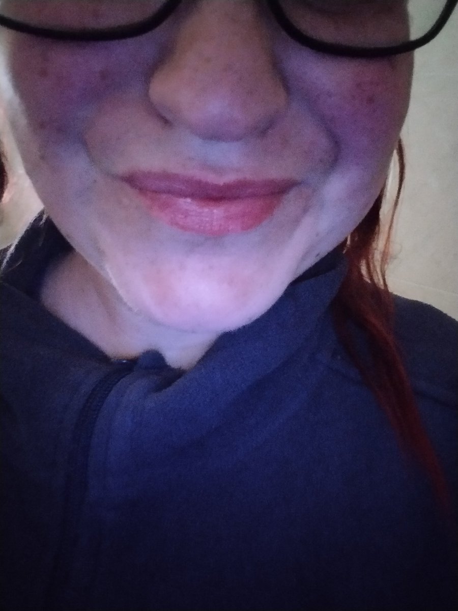 Noniná 🦇 tweet media