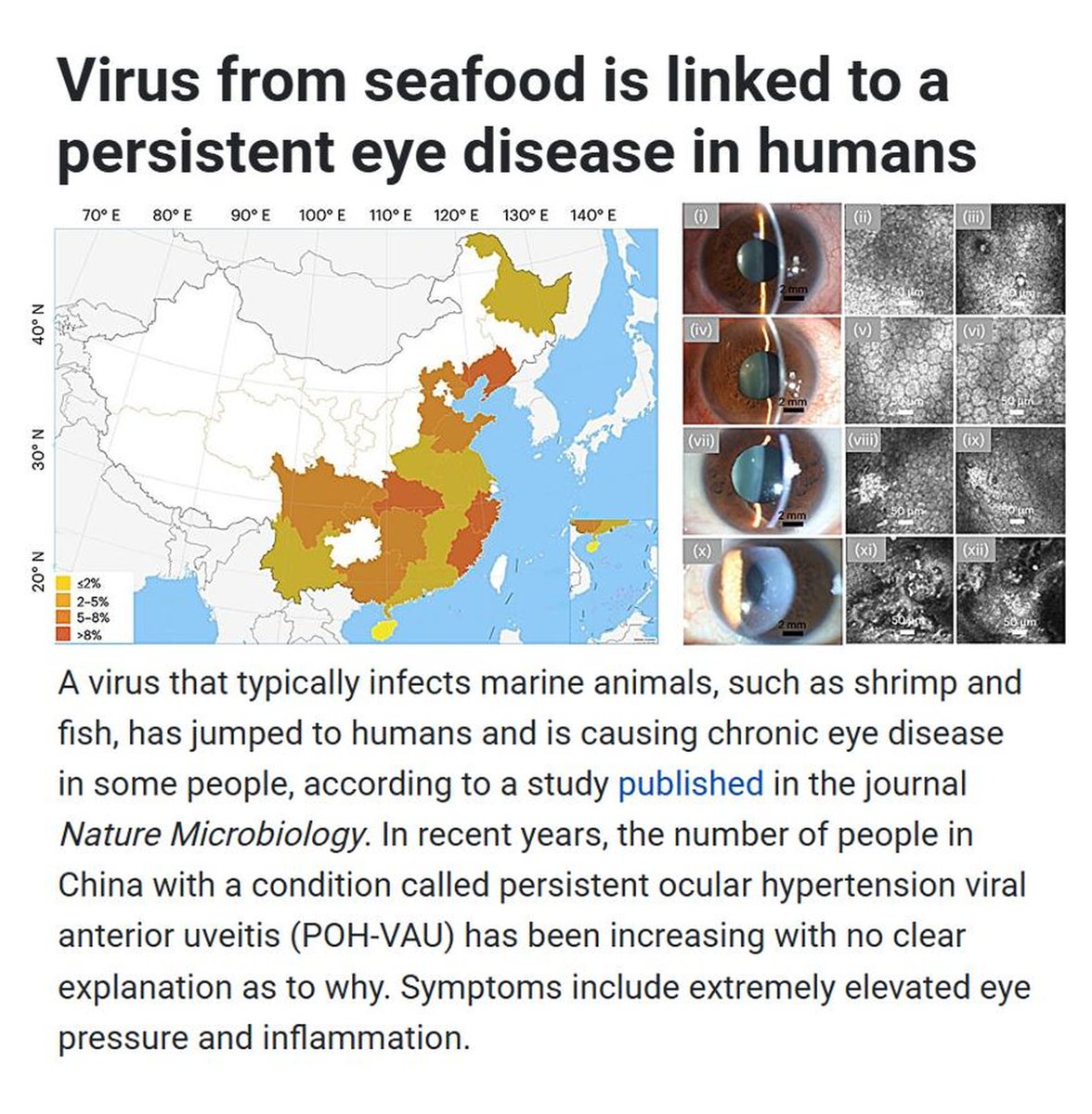 Vaccinologist's tweet image. A study in Nature #Microbiology links covert mortality nodavirus (CMNV) - found in #shrimp / #fish - to rising #eye #infections in China. Risk factors: handling raw #seafood + eating it uncooked. #OneHealth
linkedin.com/posts/drmelvin…