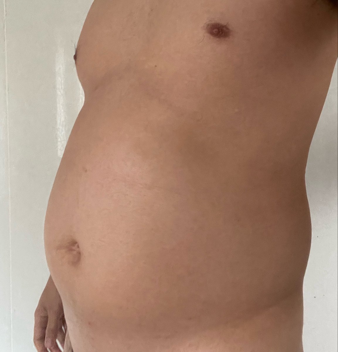 太膨狐🦊 tweet media