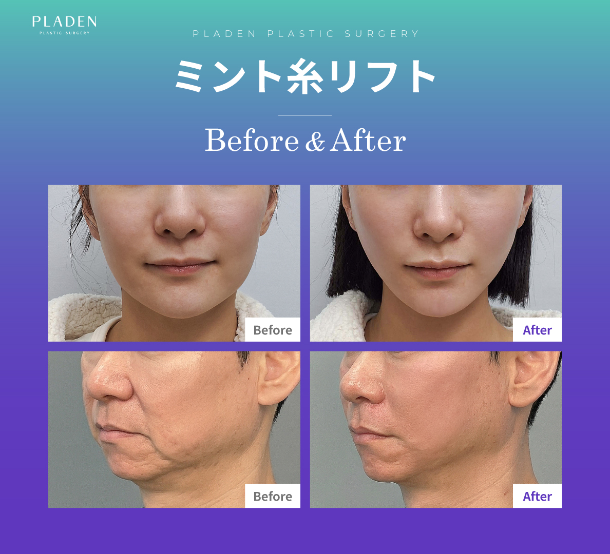 【公式】プラデン美容整形外科 tweet media