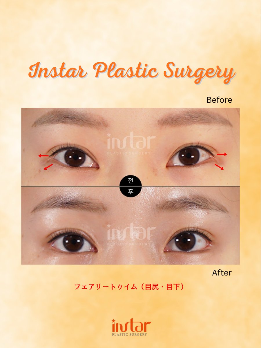 ⭐️instar整形外科⭐️ tweet media