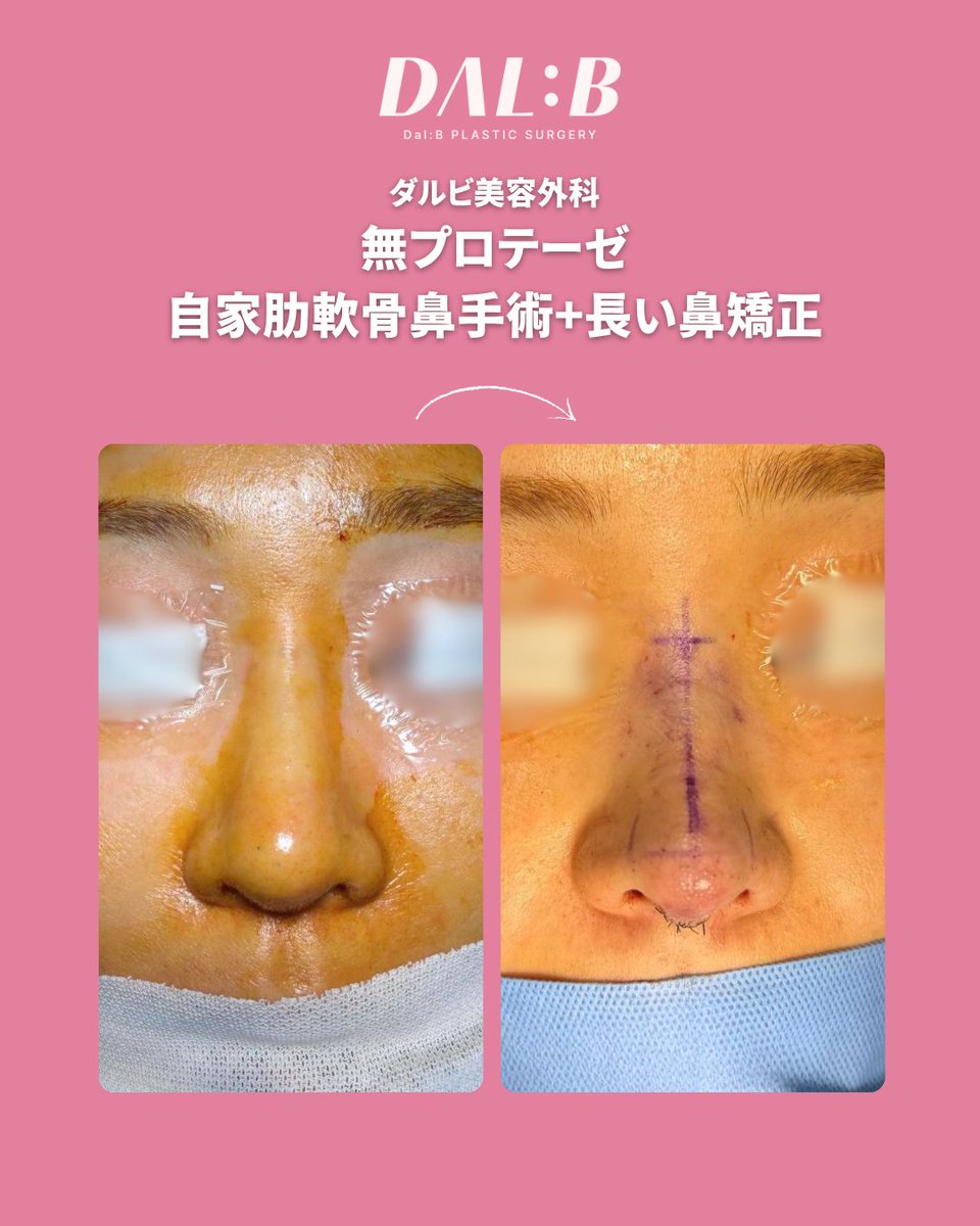 【公式】ダルビ美容外科 tweet media