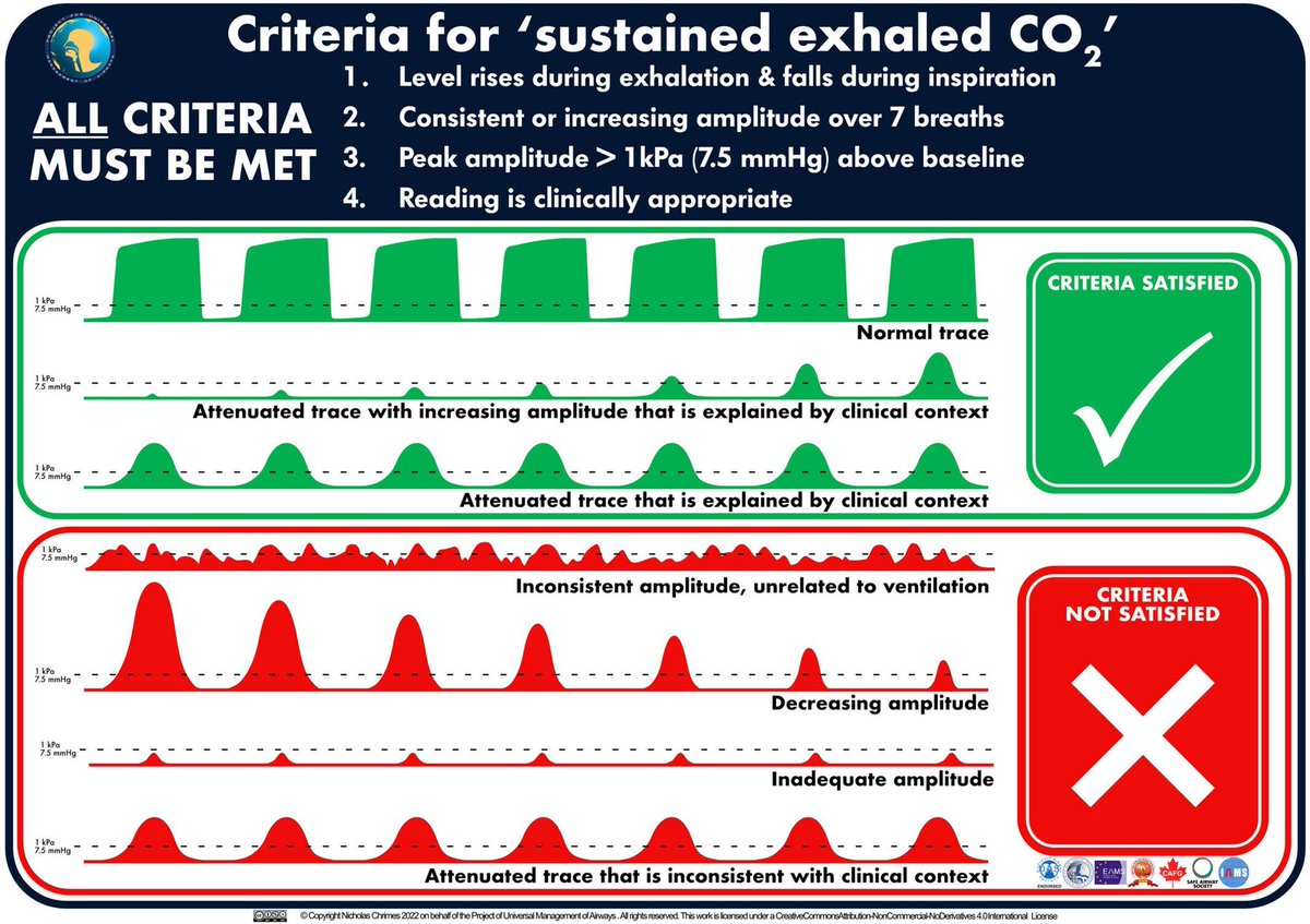 Anaes_Journal's tweet image. The PUMA Guidelines recommend evaluating at least seven administered breaths to confirm tracheal tube placement.

But why? 

It is unclear why a positive trajectory in amplitude would be expected to reverse during the fifth, sixth or seventh breaths.

#anaesthesia #MedTwitter