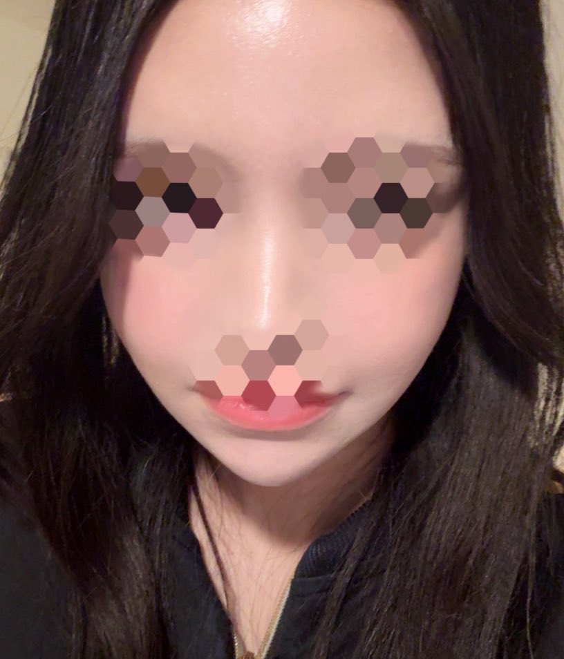 きゅるるん tweet media