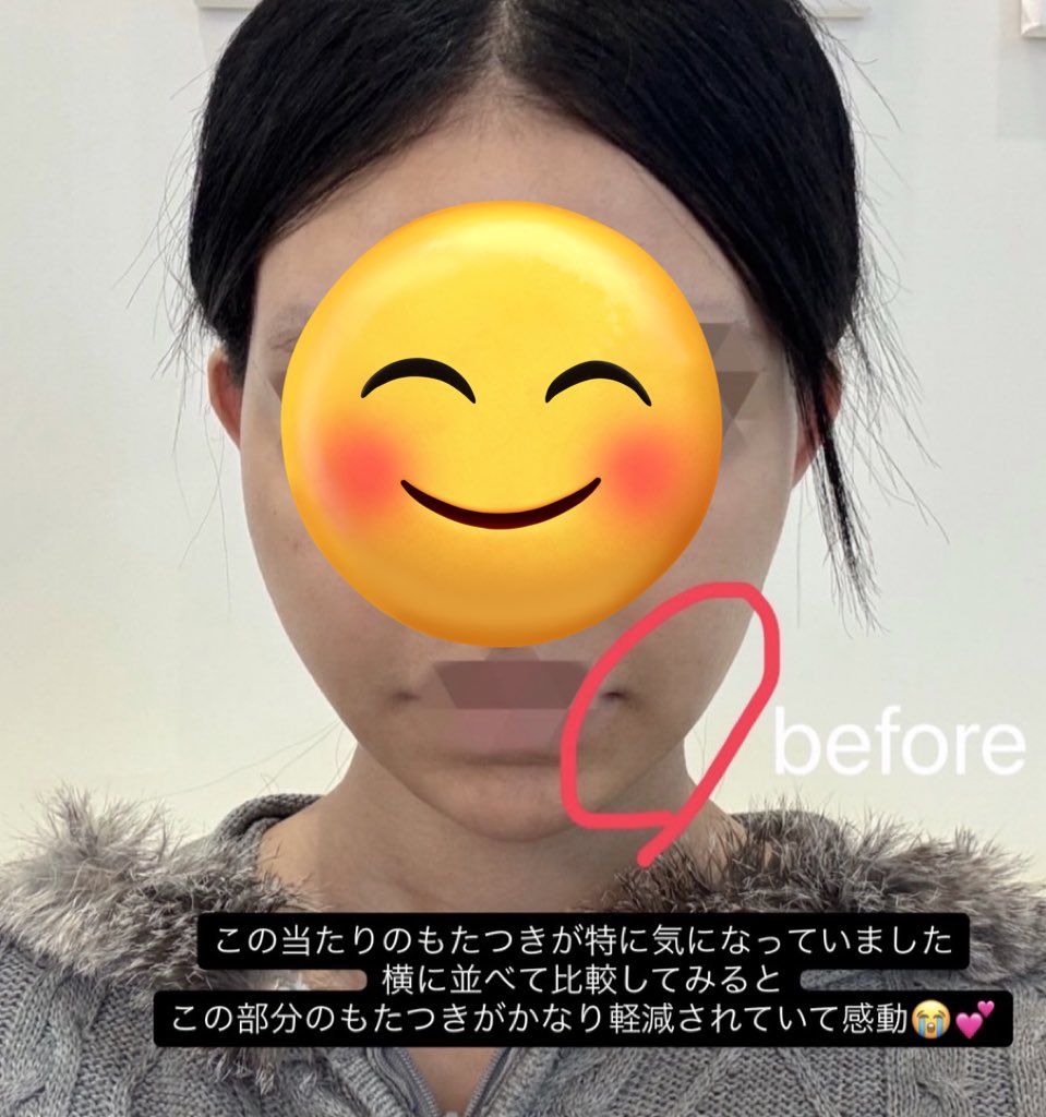 きゅるるん tweet media