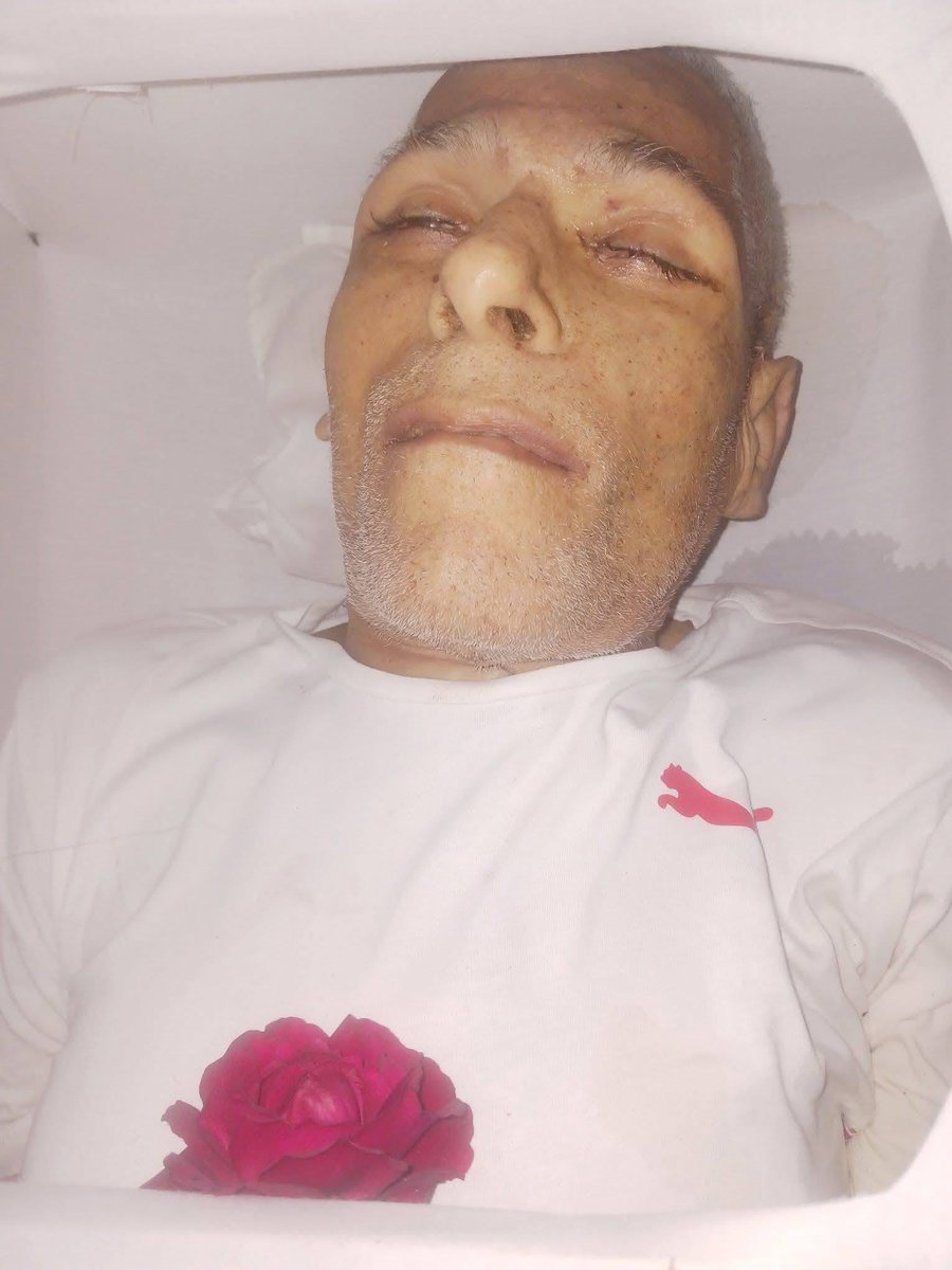 MesaYanko's tweet image. 🛑🛑 Miren como termino este hombre que estaba preso en Cuba ! Donde esta la ONU que tanto le grita y exige a Nayib Bukele por los sicarios asesinos y sus derechos  ?? Y los derechos humanos de los presos de Cuba  ?? #ONU #derechoshumanos En #cuba si se #asesina y se violan los