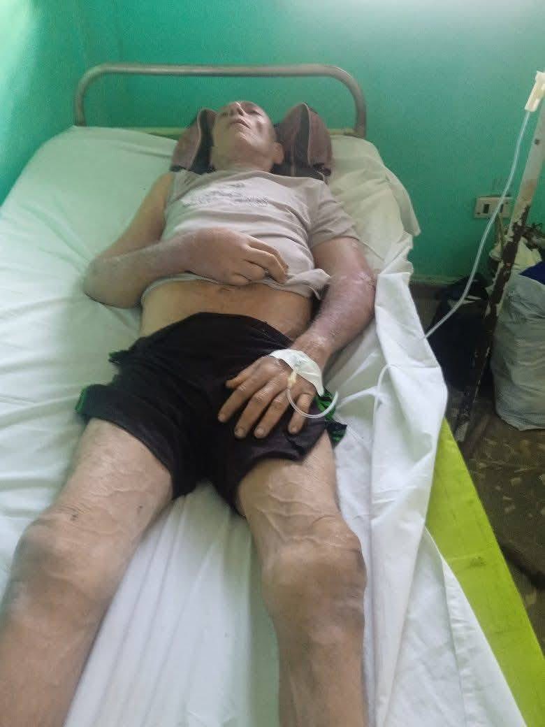 MesaYanko's tweet image. 🛑🛑 Miren como termino este hombre que estaba preso en Cuba ! Donde esta la ONU que tanto le grita y exige a Nayib Bukele por los sicarios asesinos y sus derechos  ?? Y los derechos humanos de los presos de Cuba  ?? #ONU #derechoshumanos En #cuba si se #asesina y se violan los