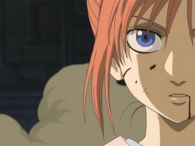 딸기곰팡이 tweet media