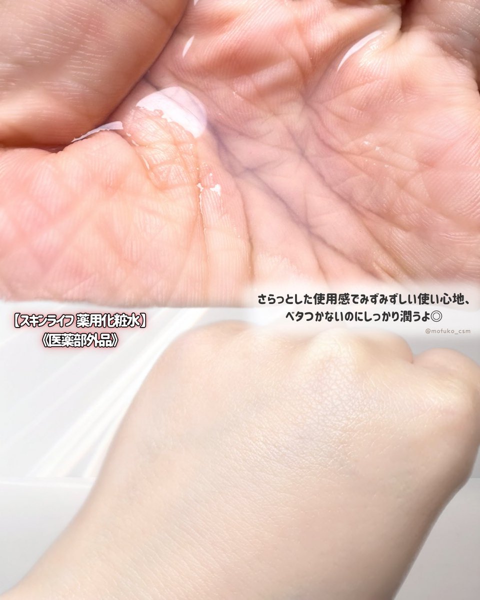 もふ子🦔よわよわ肌代表 tweet media