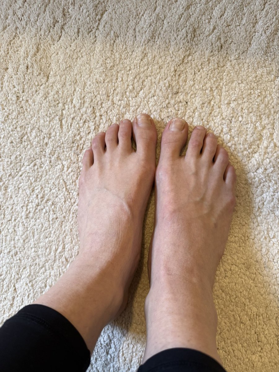 sole_secrets56's tweet photo. I think it’s time to take the girls for a treat! Anyone fancy paying? And what colour do you think they would suit ?💅🏻🩷❤️🤍💜💙
#footcare #footfetısh #footlove #feettreatment https://t.co/wTEDLL50IY
