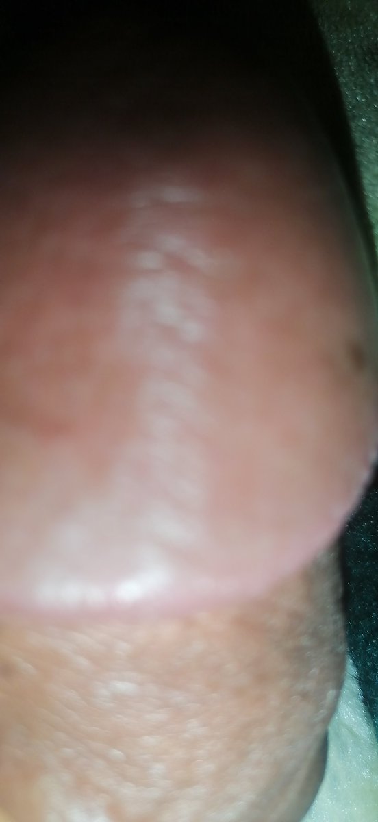 MickKate36404's tweet photo. Wanna see full? https://t.co/qcDnmSvPEw