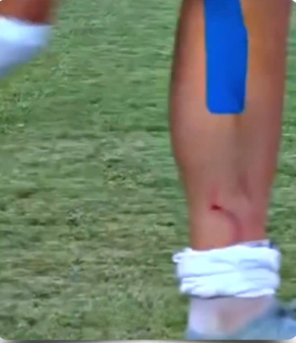 Jean C¹⁰ tweet media