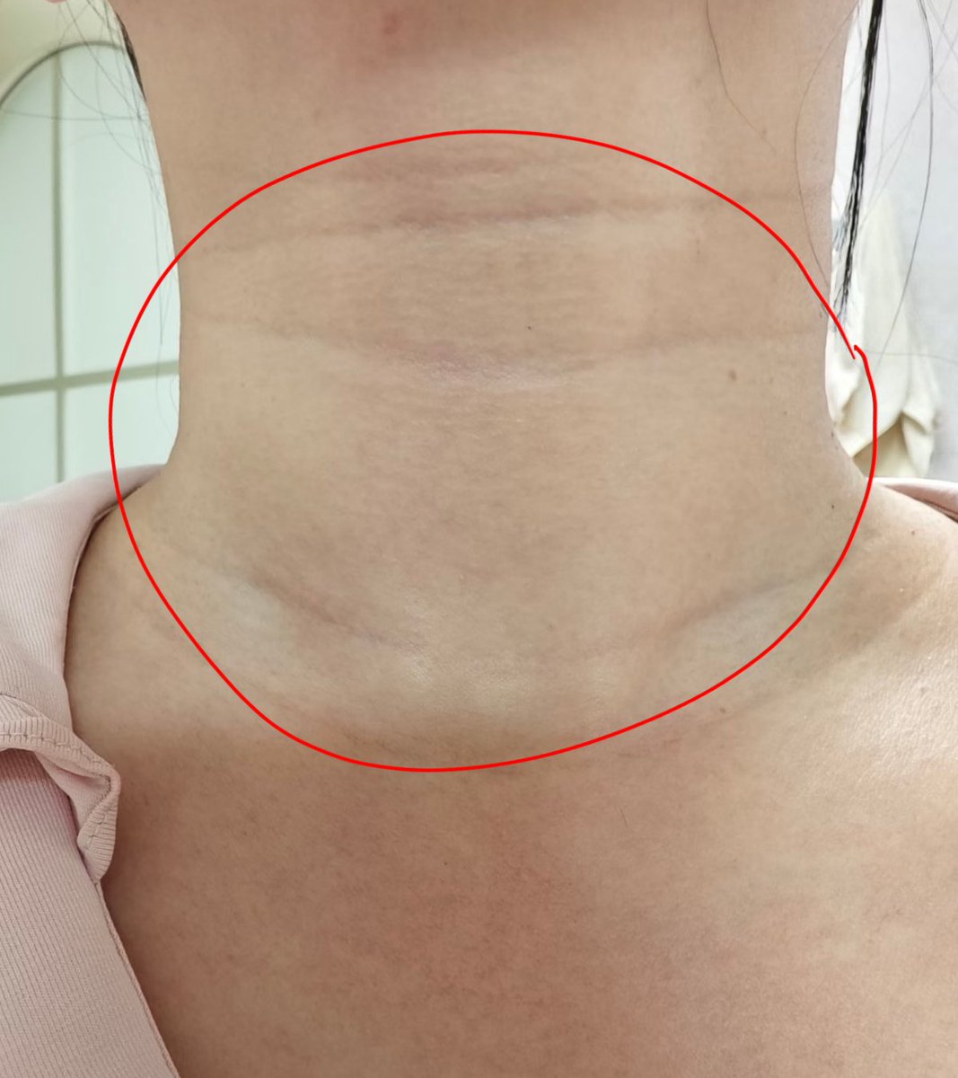 ユナ🌈 ｜垢抜け日記 tweet media