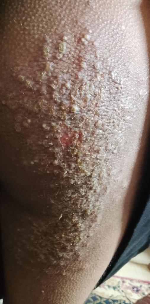 Yousef in Gaza 🇵🇸 tweet media