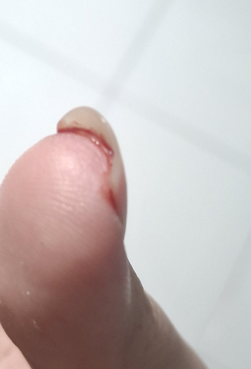 °• epril — 🫧☆~ tweet media