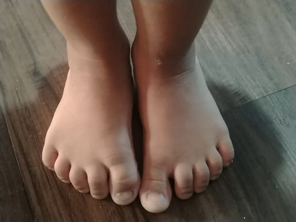 Baby feets you like it?