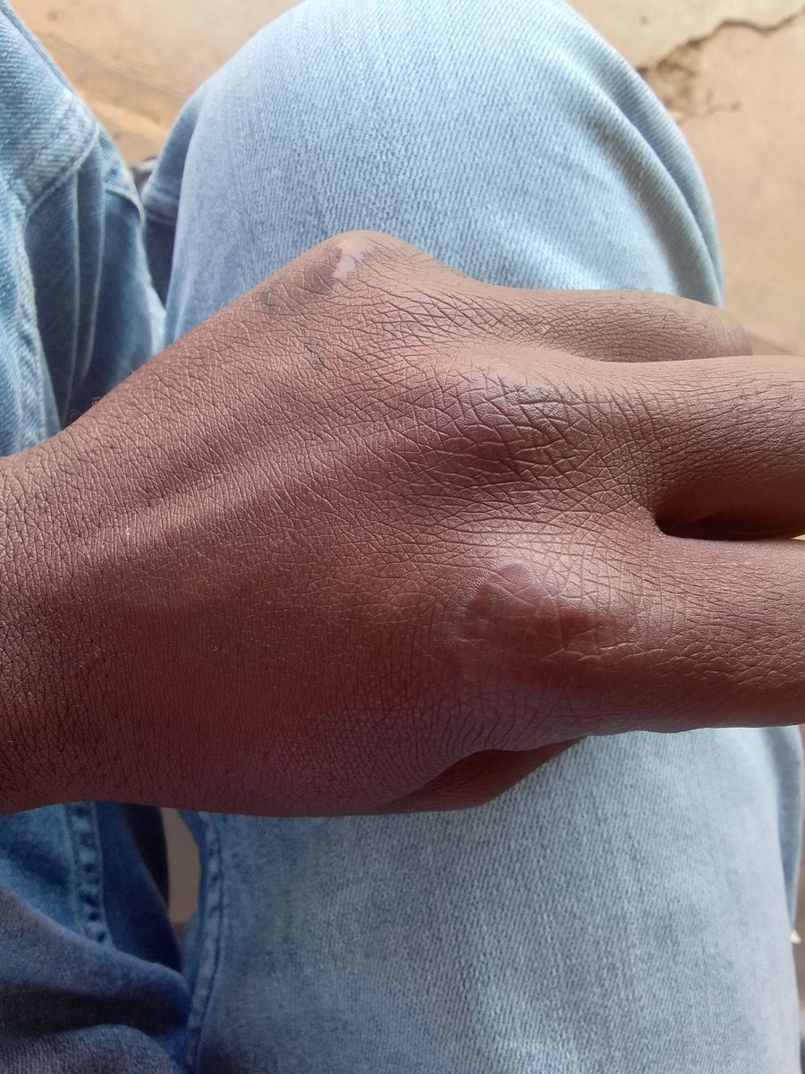 _Master_254's tweet photo. @_fwambui Niko mbili ata na the other hand also😂 https://t.co/wsUiCi0Izo