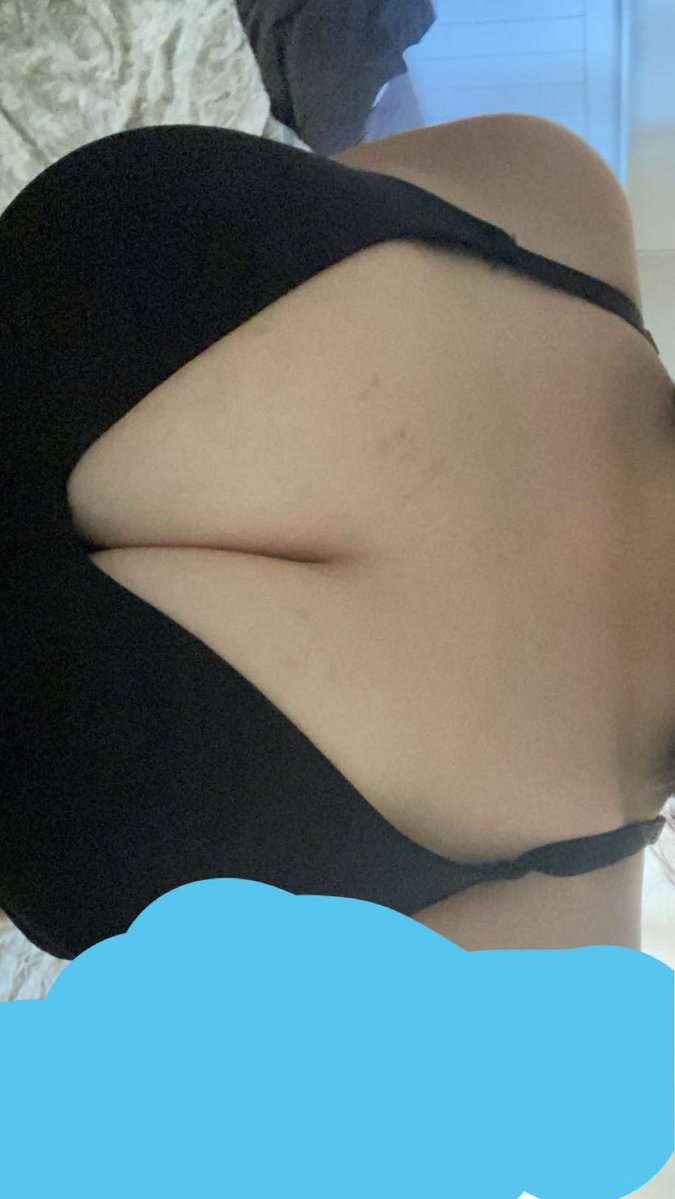 rickets / 18+ acc tweet media