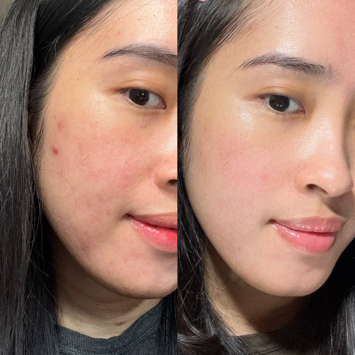 nessa🍍 tweet media