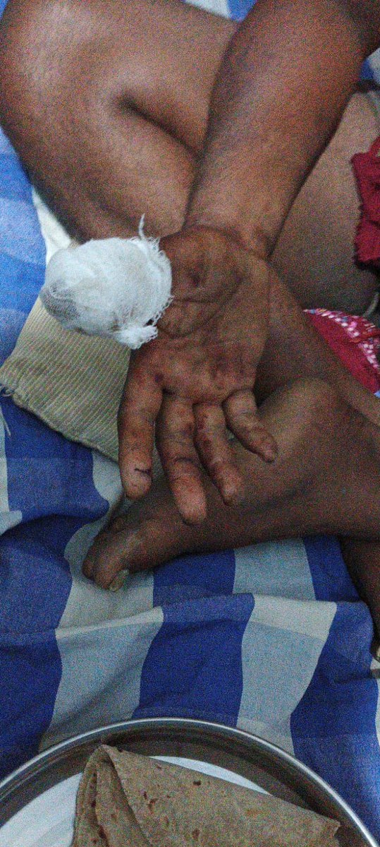 Uday B Singh tweet media