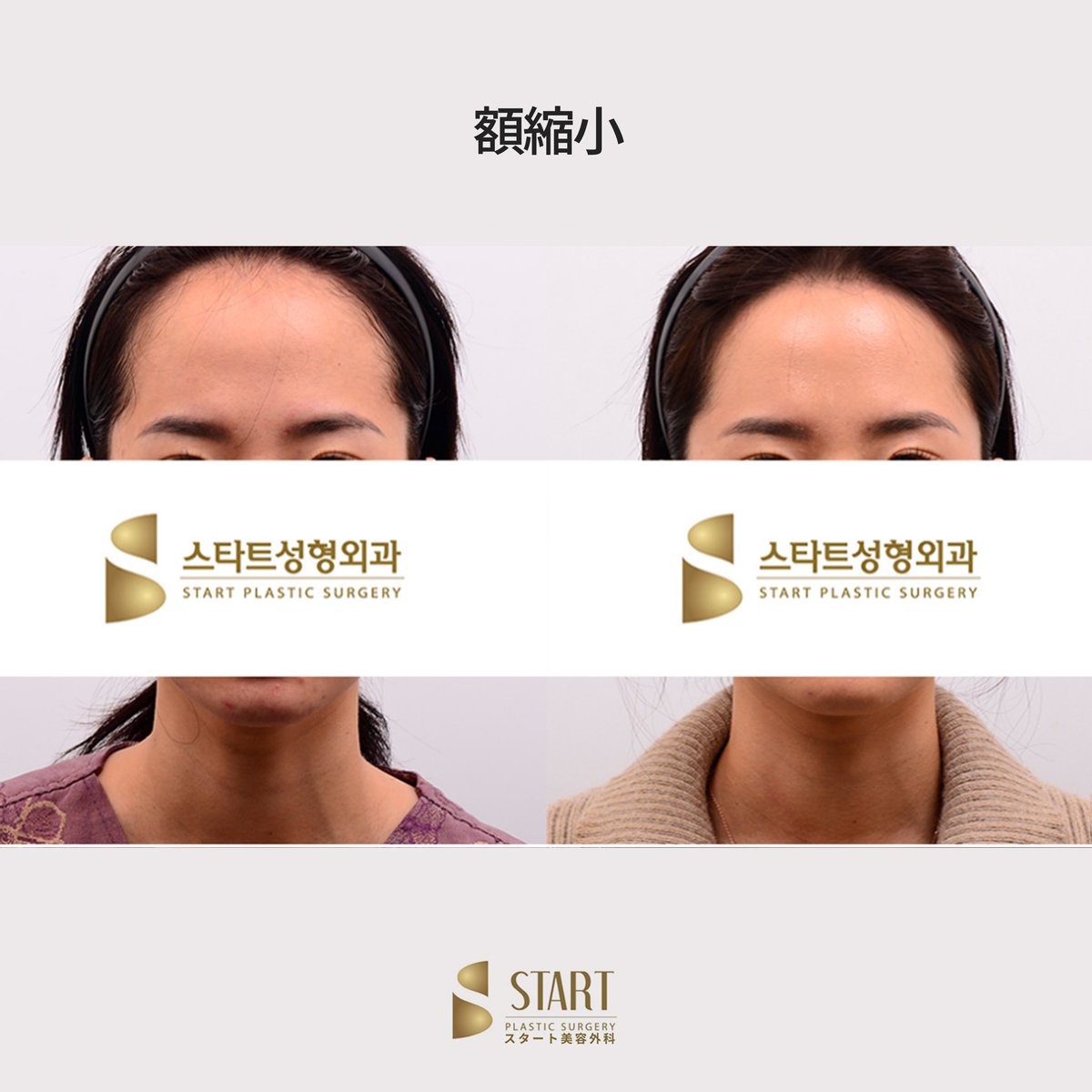 スタート整形外科 tweet media