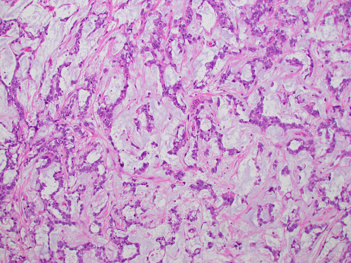 Katrina Collins, MD || Pathologist tweet media