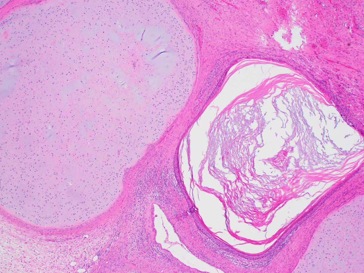 Katrina Collins, MD || Pathologist tweet media