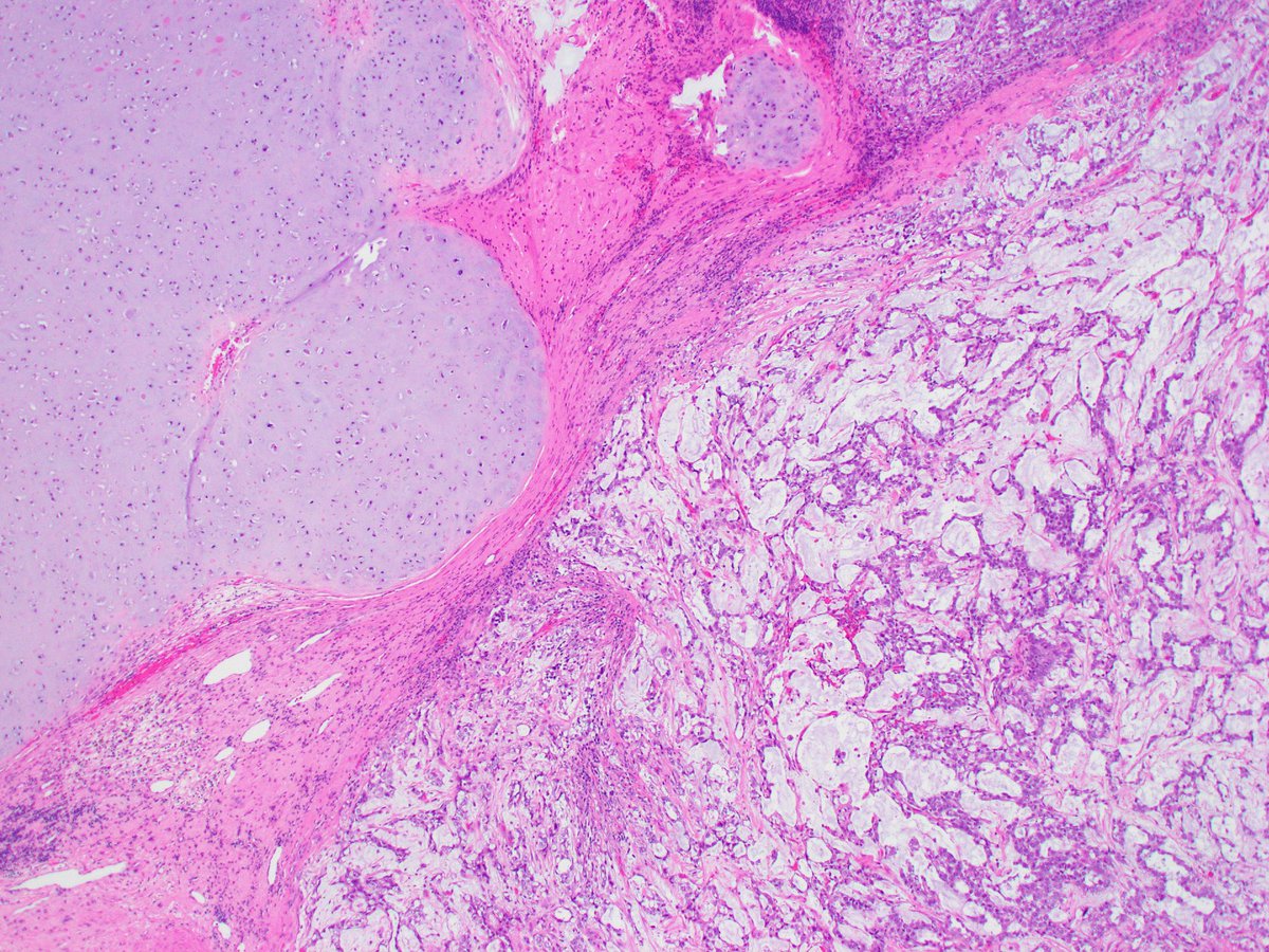 Katrina Collins, MD || Pathologist tweet media