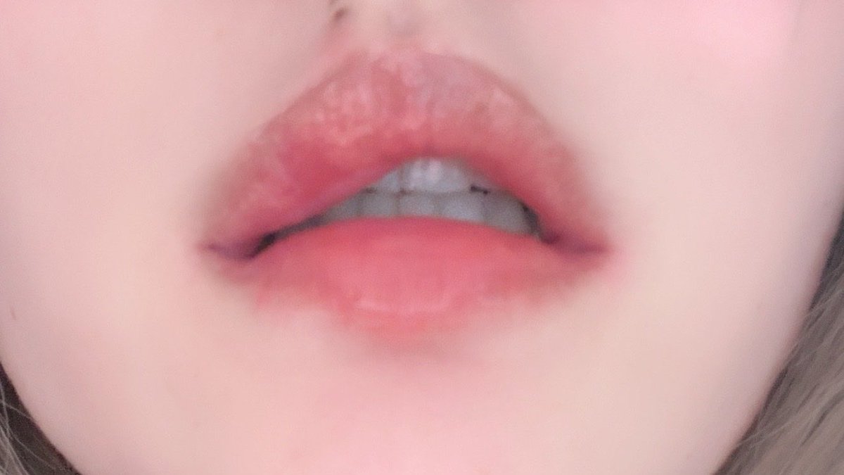 睡ちゃん tweet media